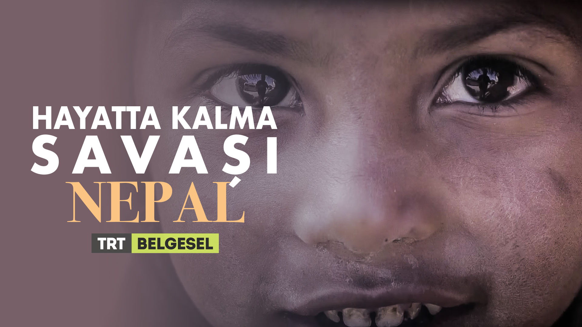 Hayatta Kalma Savaşı - Nepal - TRT Belgesel